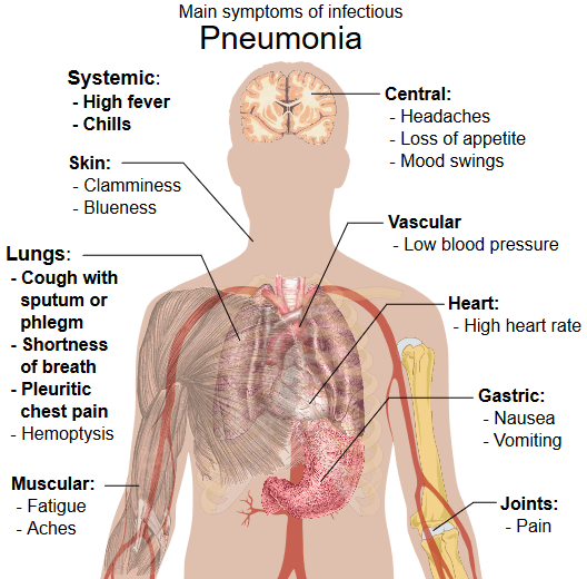 pneumonia.png